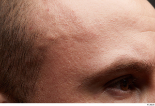 HD face Skin Joel face forehead hair skin pores skin…